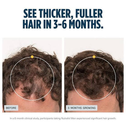 Nutrafol Men Hair Growth Supplements Ages 18–49 – 1-Month Bottle for Stronger, Thicker-Looking Hair